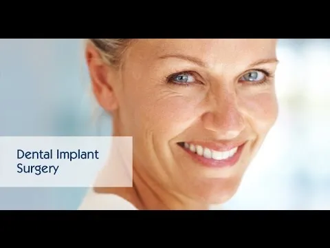 aaoms dental implant informational video